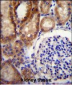 CLCN7 Antibody (C-term)